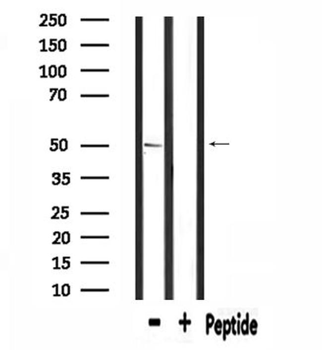 SLC39A7 Antibody in Western Blot (WB)