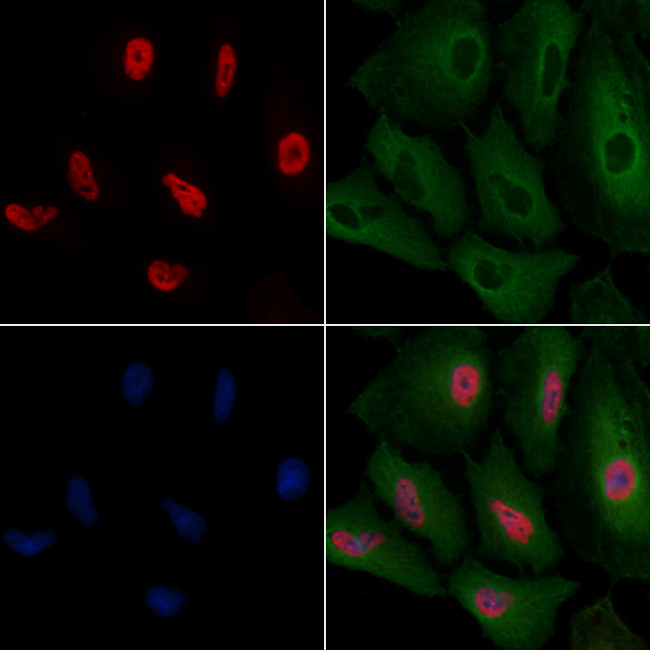 ALY Antibody in Immunocytochemistry (ICC/IF)