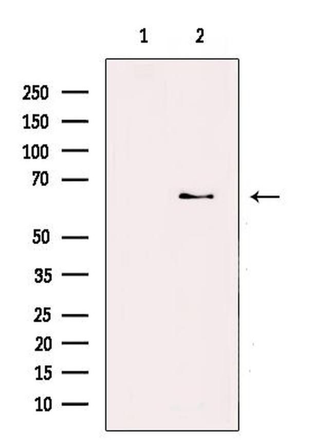 ZNF695 Antibody in Western Blot (WB)