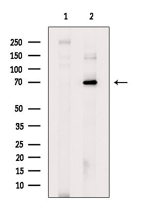 ZNF695 Antibody in Western Blot (WB)