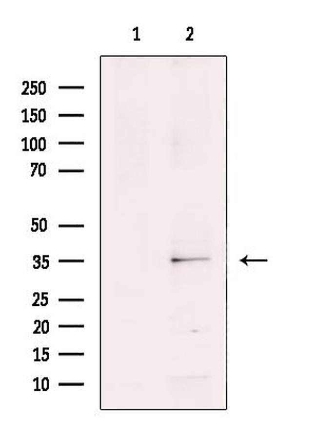 RNF113B Antibody in Western Blot (WB)