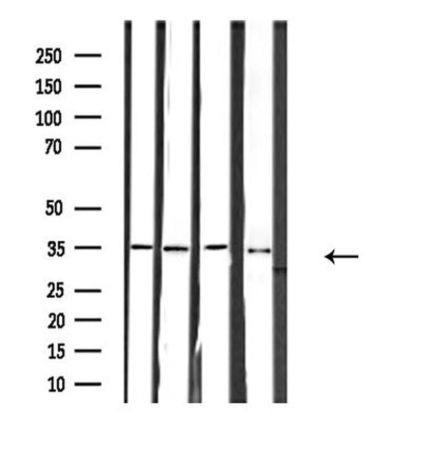 RNF113B Antibody in Western Blot (WB)