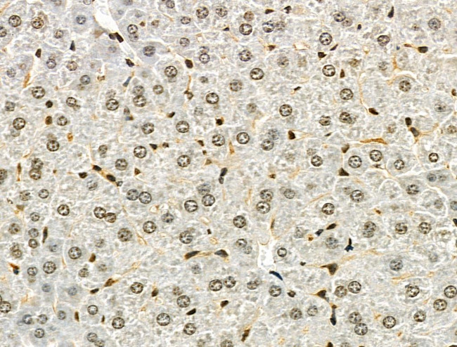 Osr2 Antibody in Immunohistochemistry (Paraffin) (IHC (P))