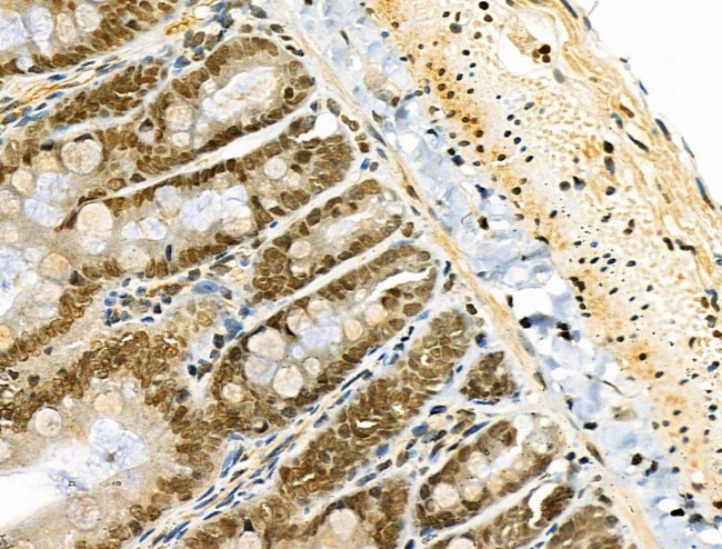 Osr2 Antibody in Immunohistochemistry (Paraffin) (IHC (P))