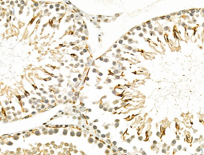 Osr2 Antibody in Immunohistochemistry (Paraffin) (IHC (P))