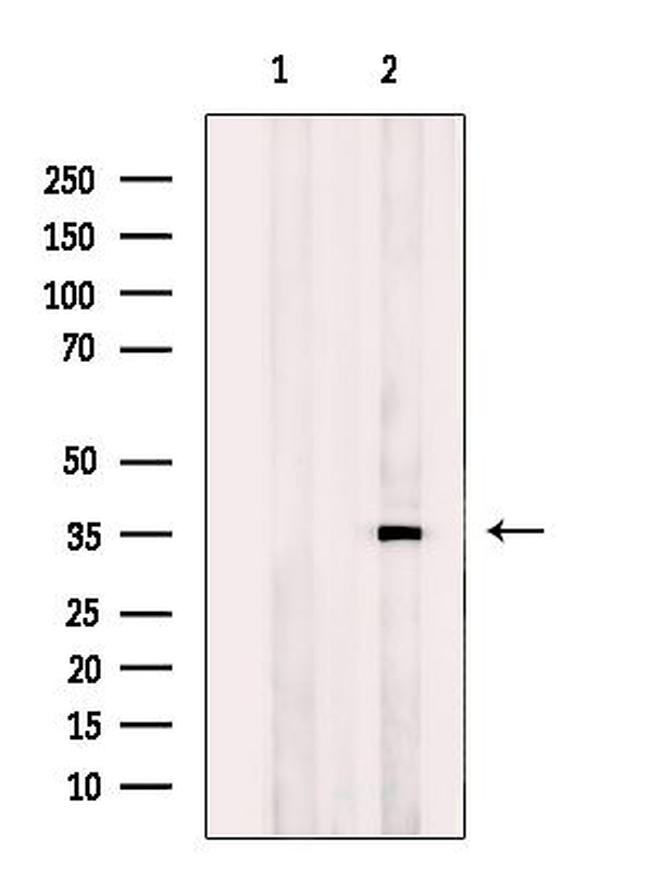 Osr2 Antibody in Western Blot (WB)