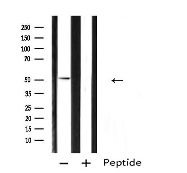 ARX Antibody in Western Blot (WB)