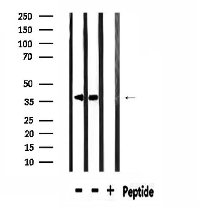 SPON2 Antibody in Western Blot (WB)