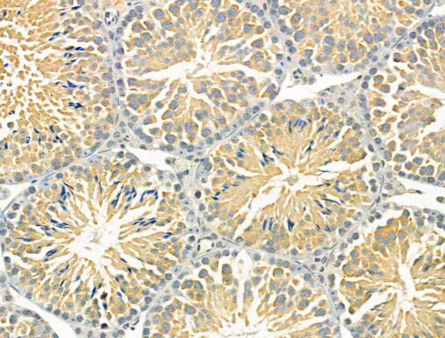 STARD10 Antibody in Immunohistochemistry (Paraffin) (IHC (P))