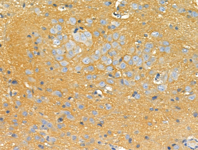 STARD10 Antibody in Immunohistochemistry (Paraffin) (IHC (P))