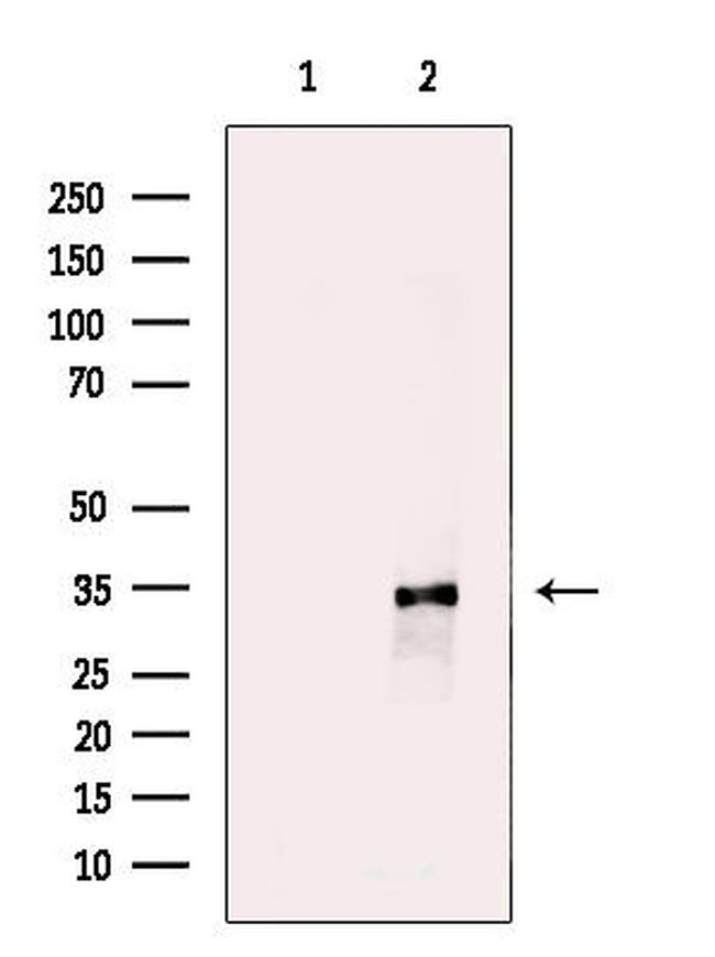 STARD10 Antibody in Western Blot (WB)