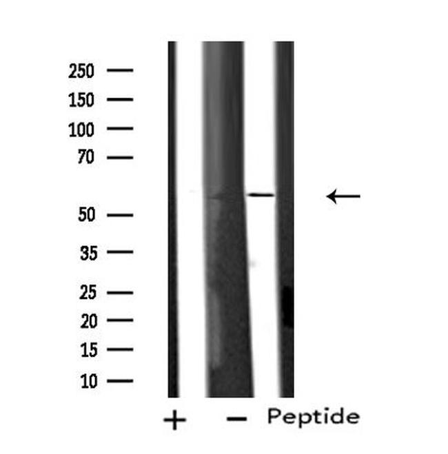 CYP11B1/CYP11B2 Antibody in Western Blot (WB)