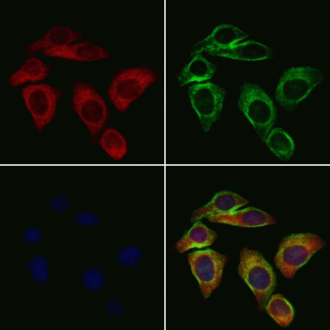 CYP11A1 Antibody in Immunocytochemistry (ICC/IF)