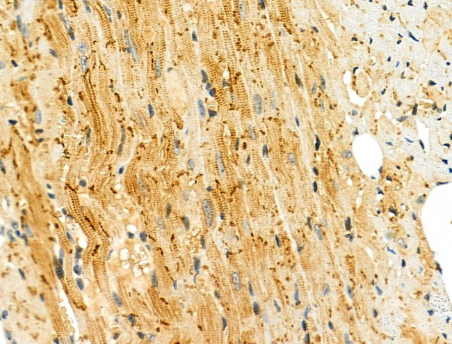 CYP11A1 Antibody in Immunohistochemistry (Paraffin) (IHC (P))