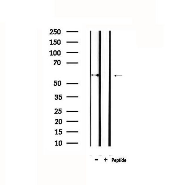 CYP11A1 Antibody in Western Blot (WB)