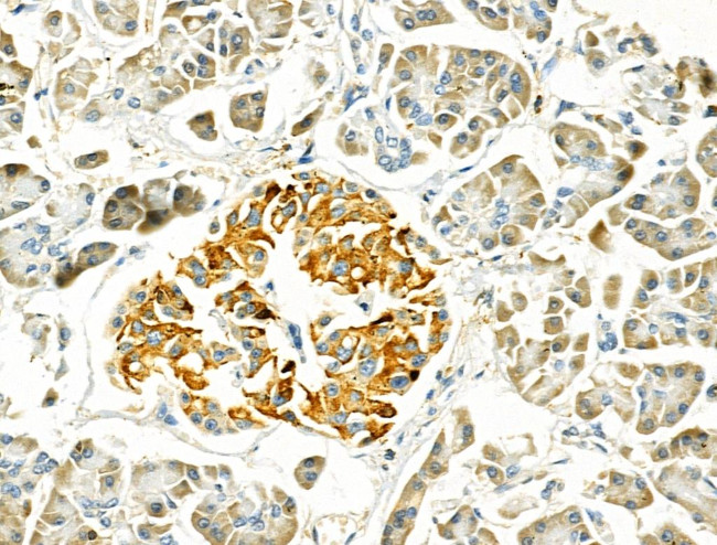 MYL3 Antibody in Immunohistochemistry (Paraffin) (IHC (P))