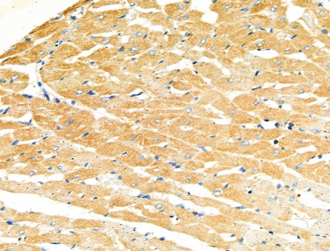 MYL3 Antibody in Immunohistochemistry (Paraffin) (IHC (P))