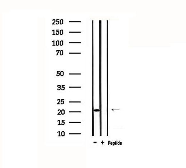 MYL3 Antibody in Western Blot (WB)