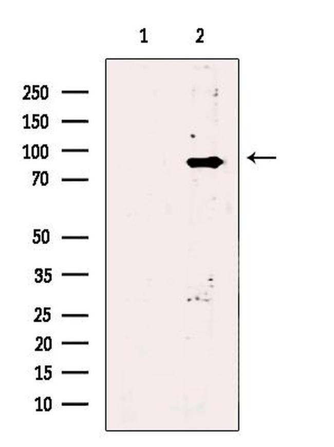 PLA2G6 Antibody in Western Blot (WB)