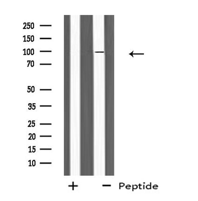 PLA2G6 Antibody in Western Blot (WB)