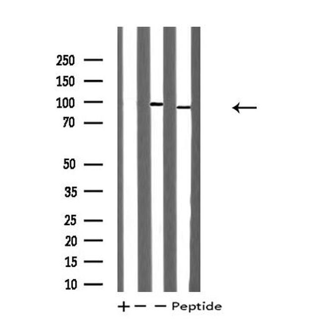 TOP1 Antibody in Western Blot (WB)