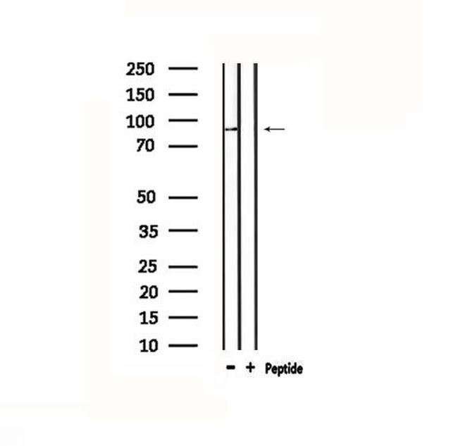 TOP1 Antibody in Western Blot (WB)