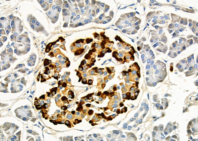 TOP1 Antibody in Immunohistochemistry (Paraffin) (IHC (P))