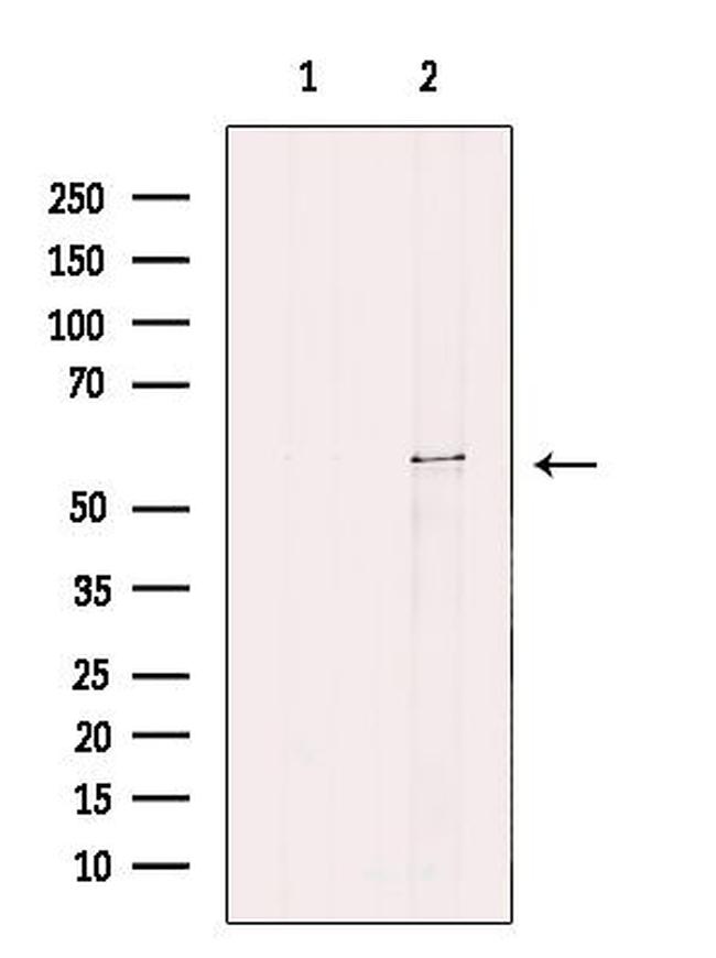 CYP26C1 Antibody in Western Blot (WB)