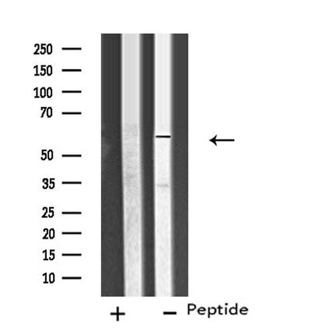 CYP26C1 Antibody in Western Blot (WB)