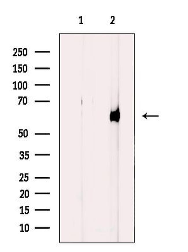 CYP4V2 Antibody in Western Blot (WB)