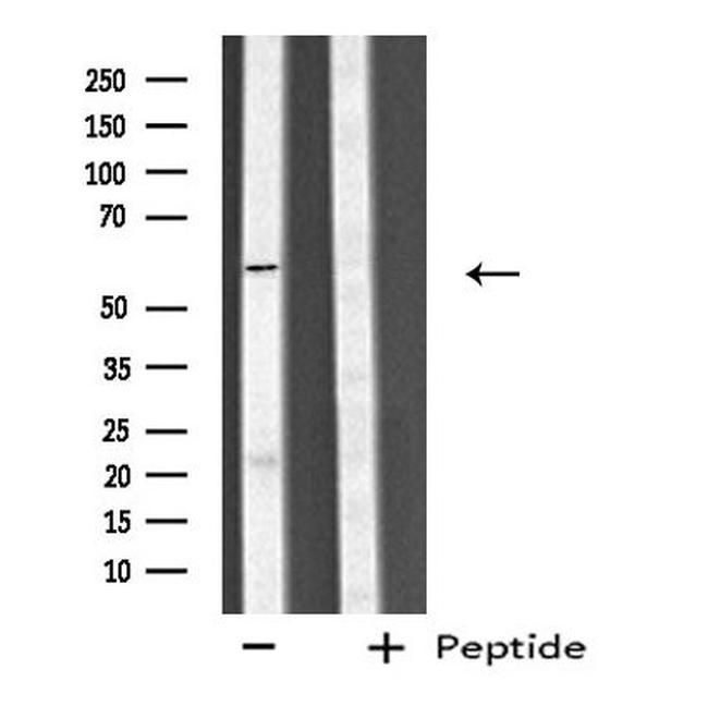 CYP4V2 Antibody in Western Blot (WB)