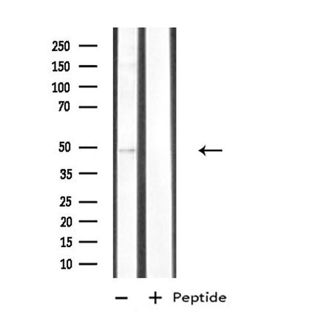 CK1 delta Antibody in Western Blot (WB)