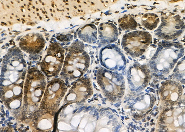 CK1 delta Antibody in Immunohistochemistry (Paraffin) (IHC (P))