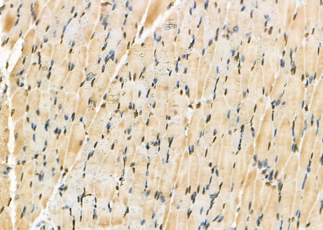 CK1 delta Antibody in Immunohistochemistry (Paraffin) (IHC (P))