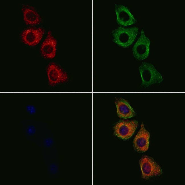 MATK Antibody in Immunocytochemistry (ICC/IF)