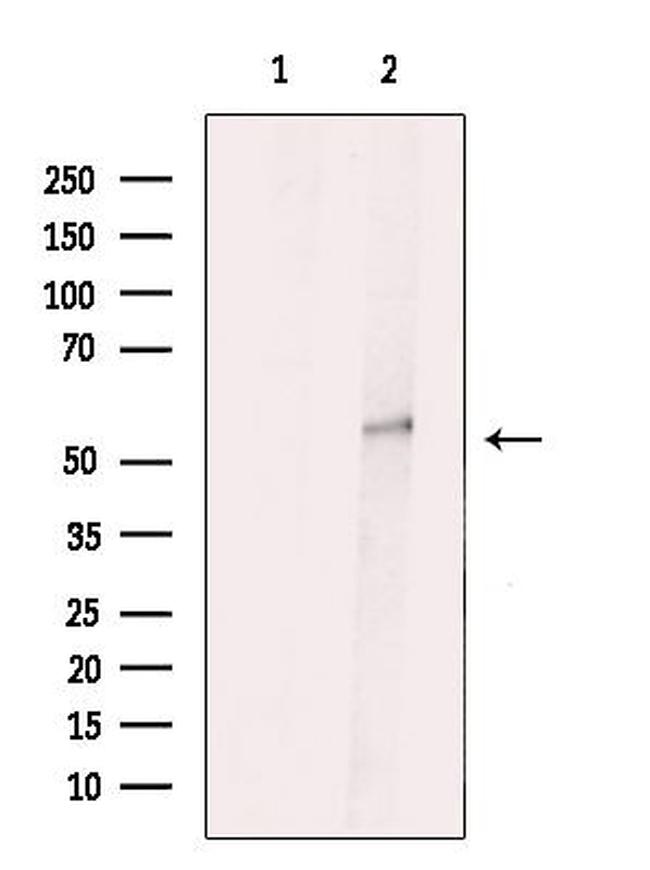 VRK3 Antibody in Western Blot (WB)