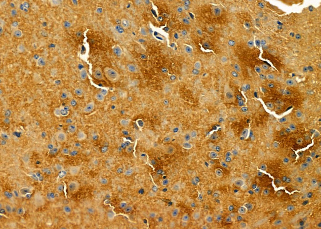 LRP8 Antibody in Immunohistochemistry (Paraffin) (IHC (P))