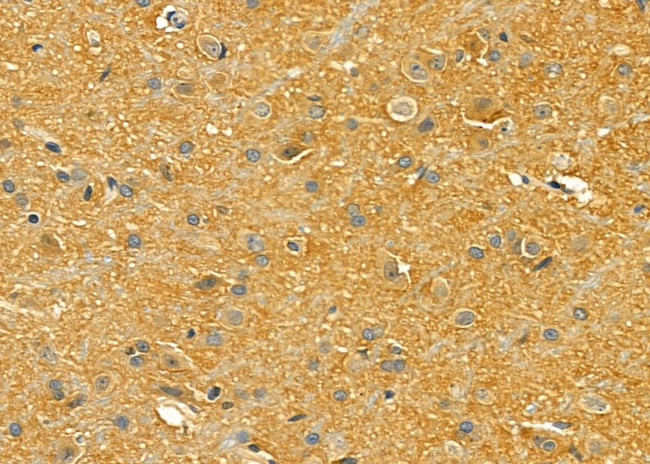 LRP8 Antibody in Immunohistochemistry (Paraffin) (IHC (P))