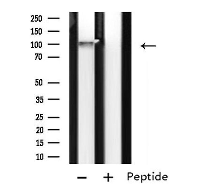 LRP8 Antibody in Western Blot (WB)