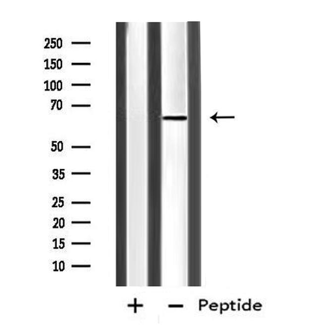 IL4I1 Antibody in Western Blot (WB)