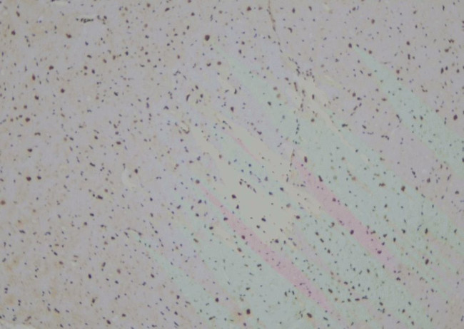 LIM1 Antibody in Immunohistochemistry (Paraffin) (IHC (P))