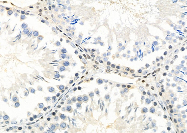 Opsin 3 Antibody in Immunohistochemistry (Paraffin) (IHC (P))