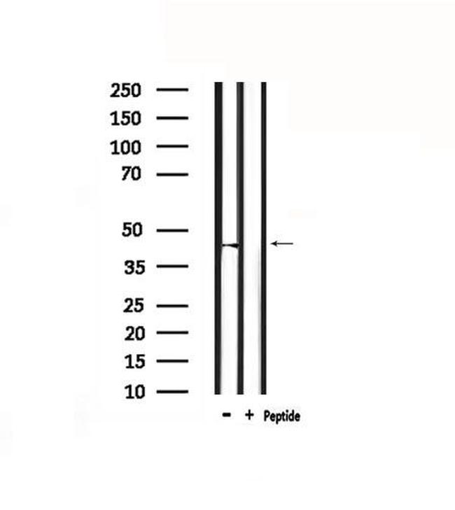 Opsin 3 Antibody in Western Blot (WB)