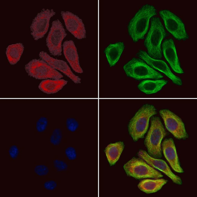 GPR109B Antibody in Immunocytochemistry (ICC/IF)