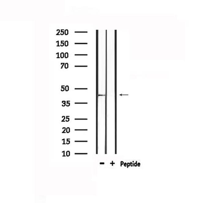 GPR109B Antibody in Western Blot (WB)