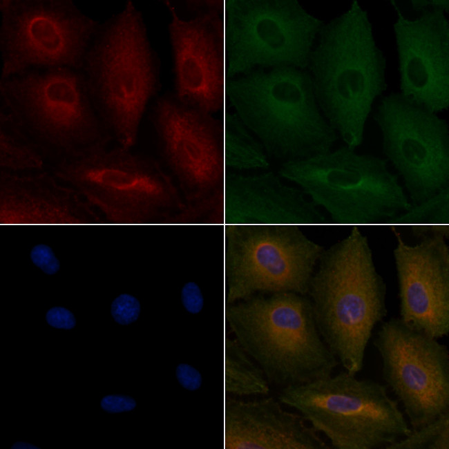 GPR109B Antibody in Immunocytochemistry (ICC/IF)