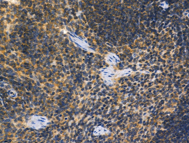 GPR109B Antibody in Immunohistochemistry (Paraffin) (IHC (P))