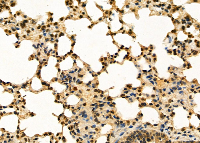 AGTR1 Antibody in Immunohistochemistry (Paraffin) (IHC (P))