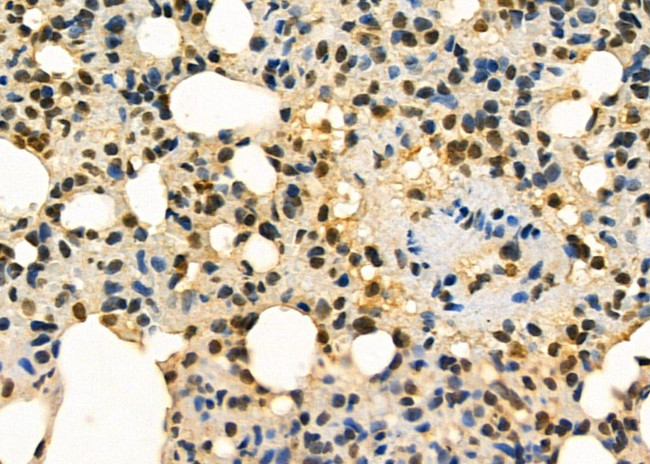 AGTR1 Antibody in Immunohistochemistry (Paraffin) (IHC (P))