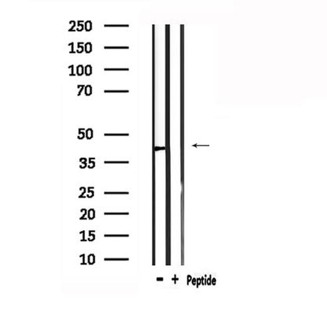 AGTR1 Antibody in Western Blot (WB)